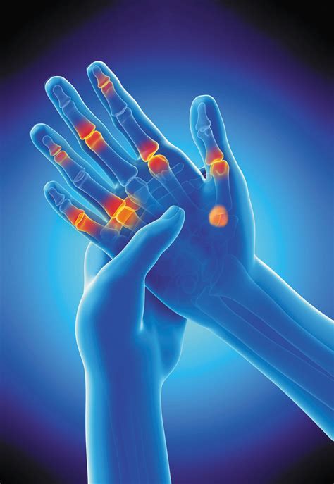Effective Strategies to Naturally Relieve Arthritis Pain