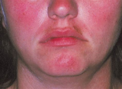 How to Make Your Face Not Red: A Comprehensive Guide to Calm Skin