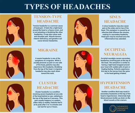 Effective Ways to Relieve Headaches: Your Guide to Comfort and Well-being