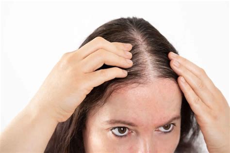 Regain Confidence: Effective Strategies for Thinning Hair