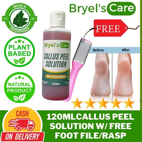 Achieve Silky Smooth Feet: Your Ultimate Guide to a Callus-Free Life