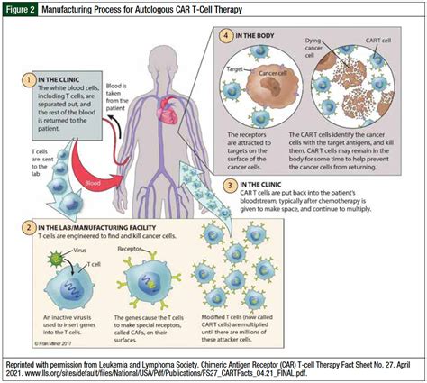 CAR T-Cell Therapy: A Revolutionary Approach to Cancer Treatment
