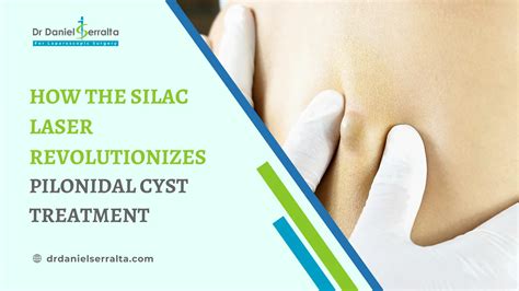 Pilonidal Cyst Laser Surgery in USA: A Modern Path to Healing